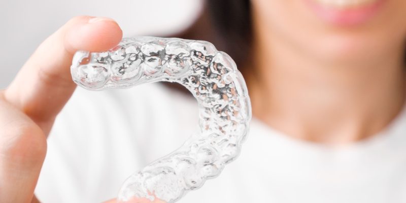 la importancia de los retenedores después de la ortodoncia