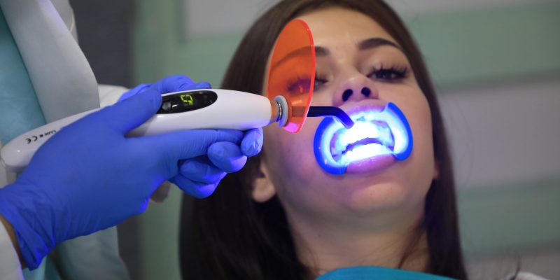blanqueamiento dental con led