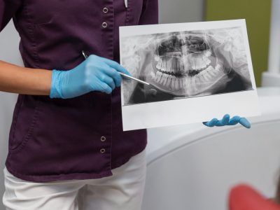 ¿Qué es una ortopantomografía?